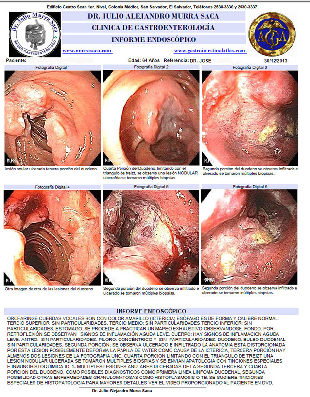 Gastroenterologia San Salvador