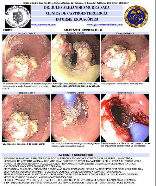 Medico Gastroenterologo El Salvador