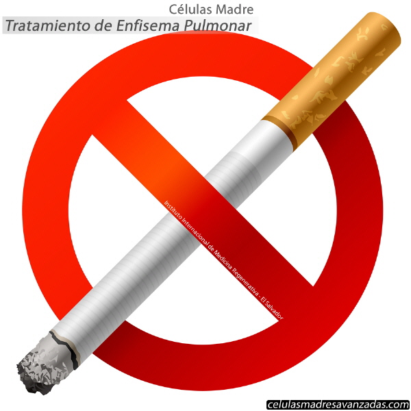 Céluas Madre El Salvador Tratamientos