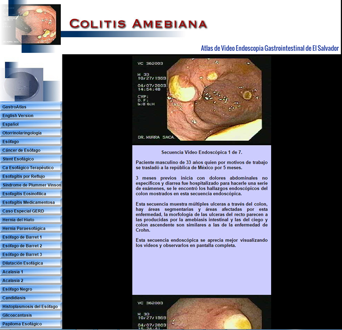 Gastroenterologia El Salvador