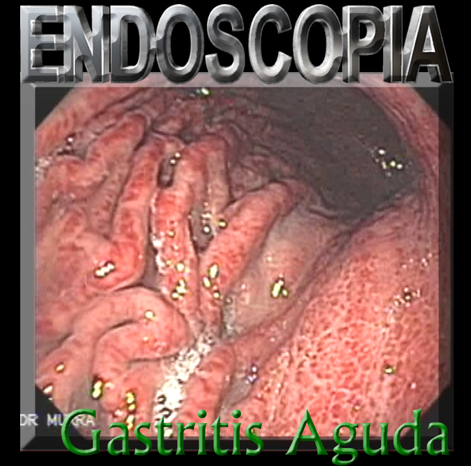 Endoscopia El Salvador