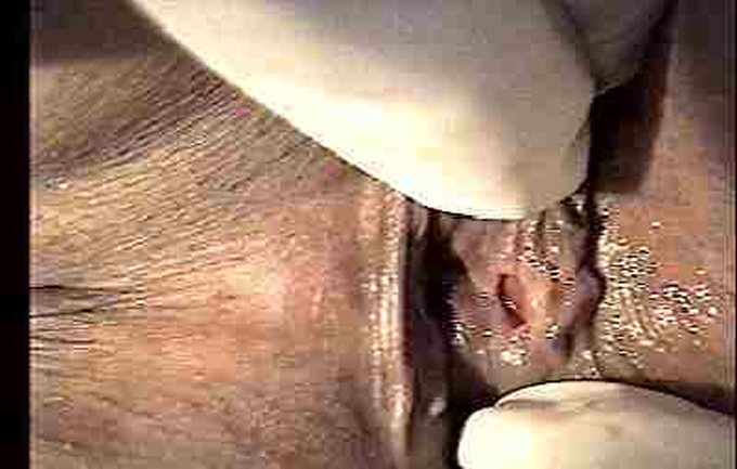 Hemorroides El Salvador