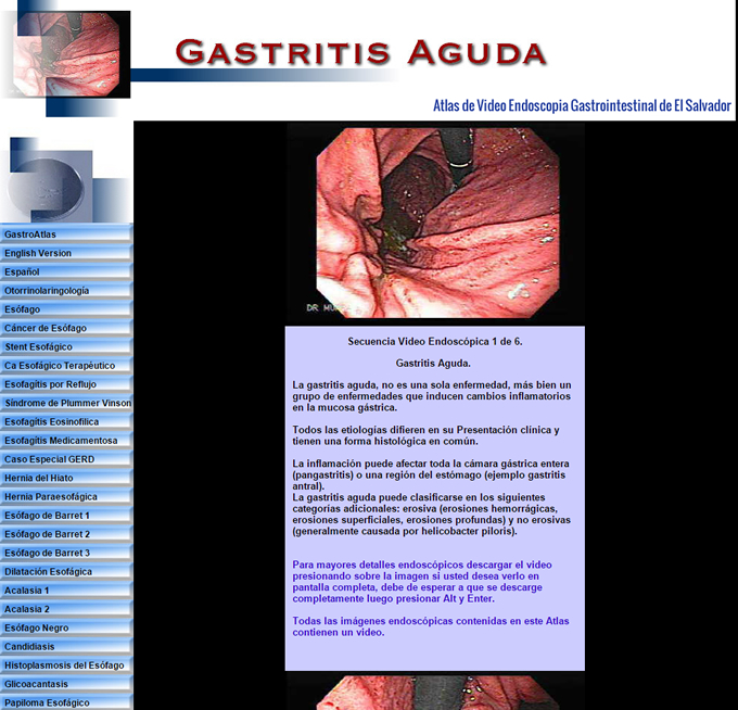 Medico Internista El Salvador