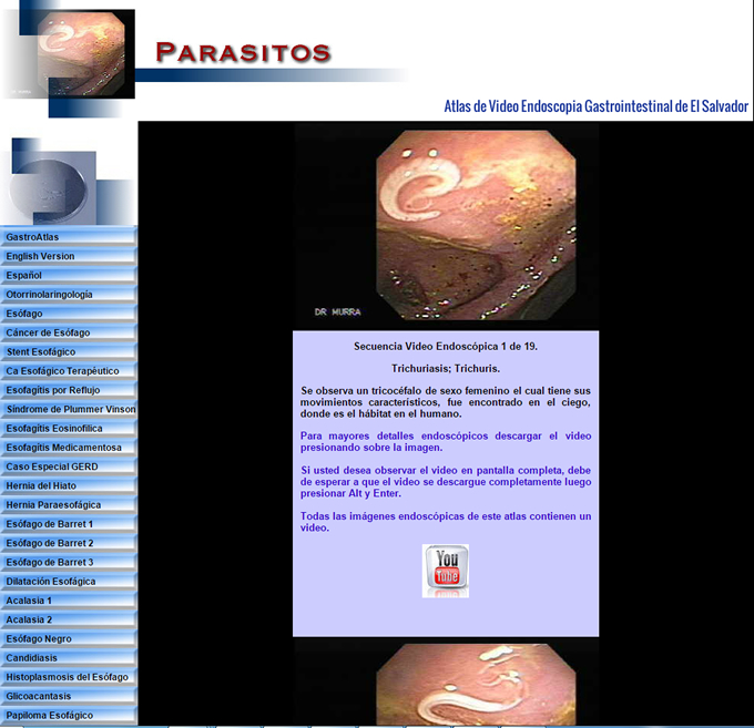 Gastroenterologia El Salvador