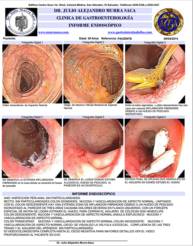 Gastroenterologia El Salvador