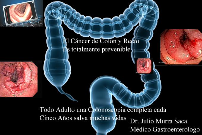 Gastroenterologia El Salvador