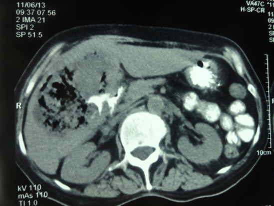 Gastroenterologo Santa Ana