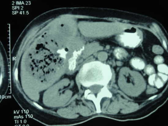 Gastroenterologo San Miguel