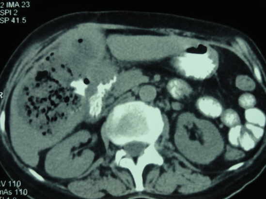Endoscopia San Miguel
