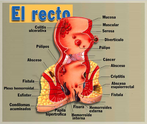 Proctologia El salvador
